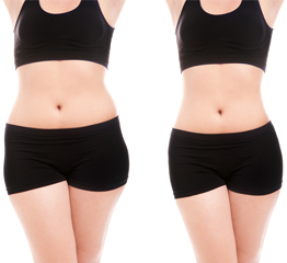 Before and After Body Contouring Treatment in Pasadena, CA
